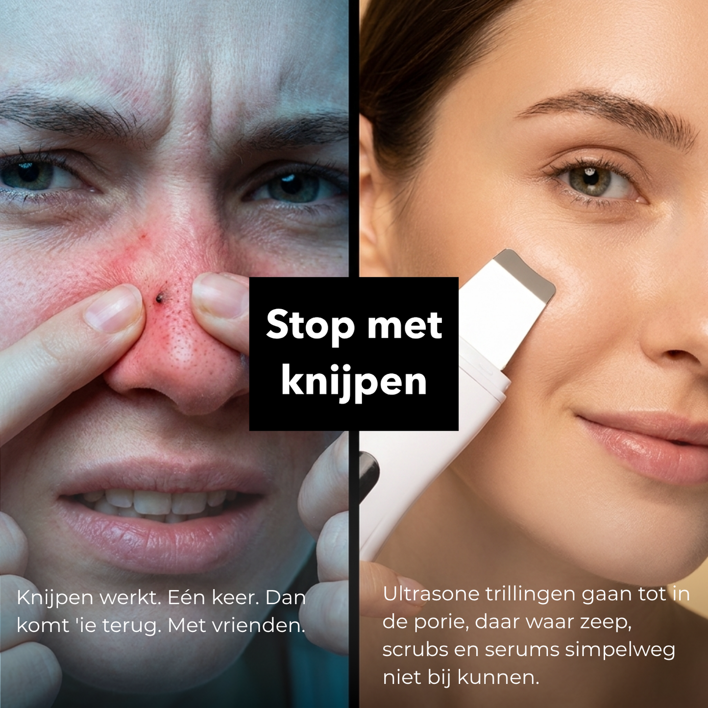 Ultra Gezichtsreiniger Pro - Pakt huidproblemen doelgericht aan