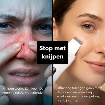 Ultra Gezichtsreiniger Pro - Pakt huidproblemen doelgericht aan