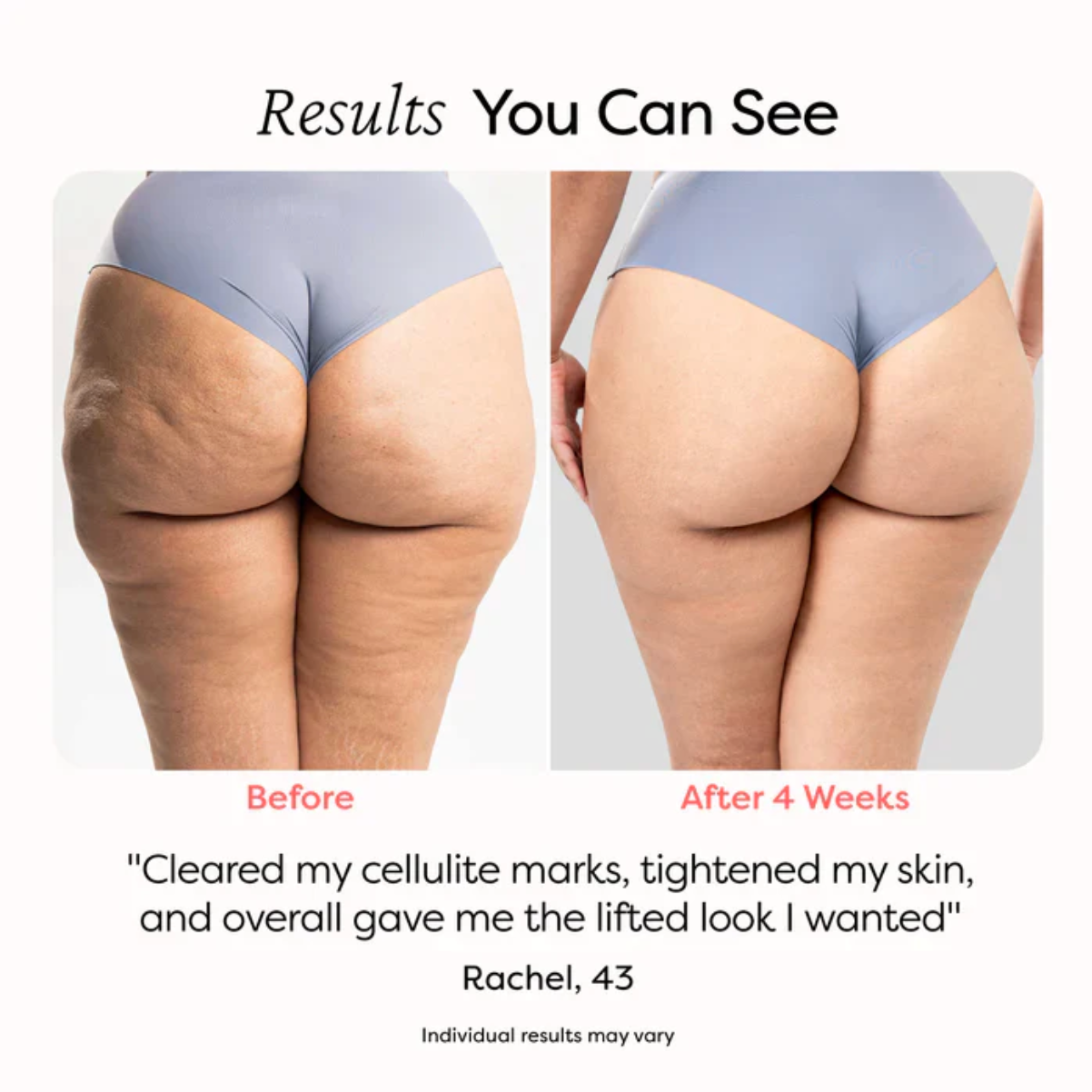 Anti-Cellulitis Roller - De salon behandeling voor thuis