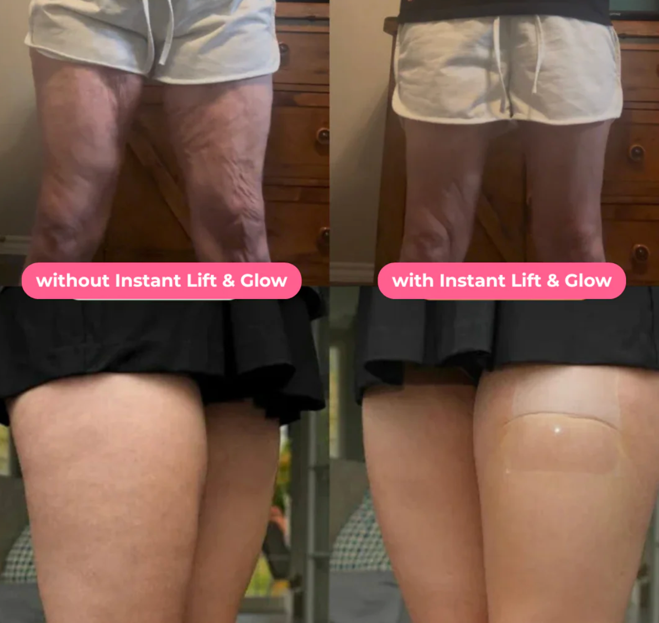 Anti-Cellulitis Roller - De salon behandeling voor thuis