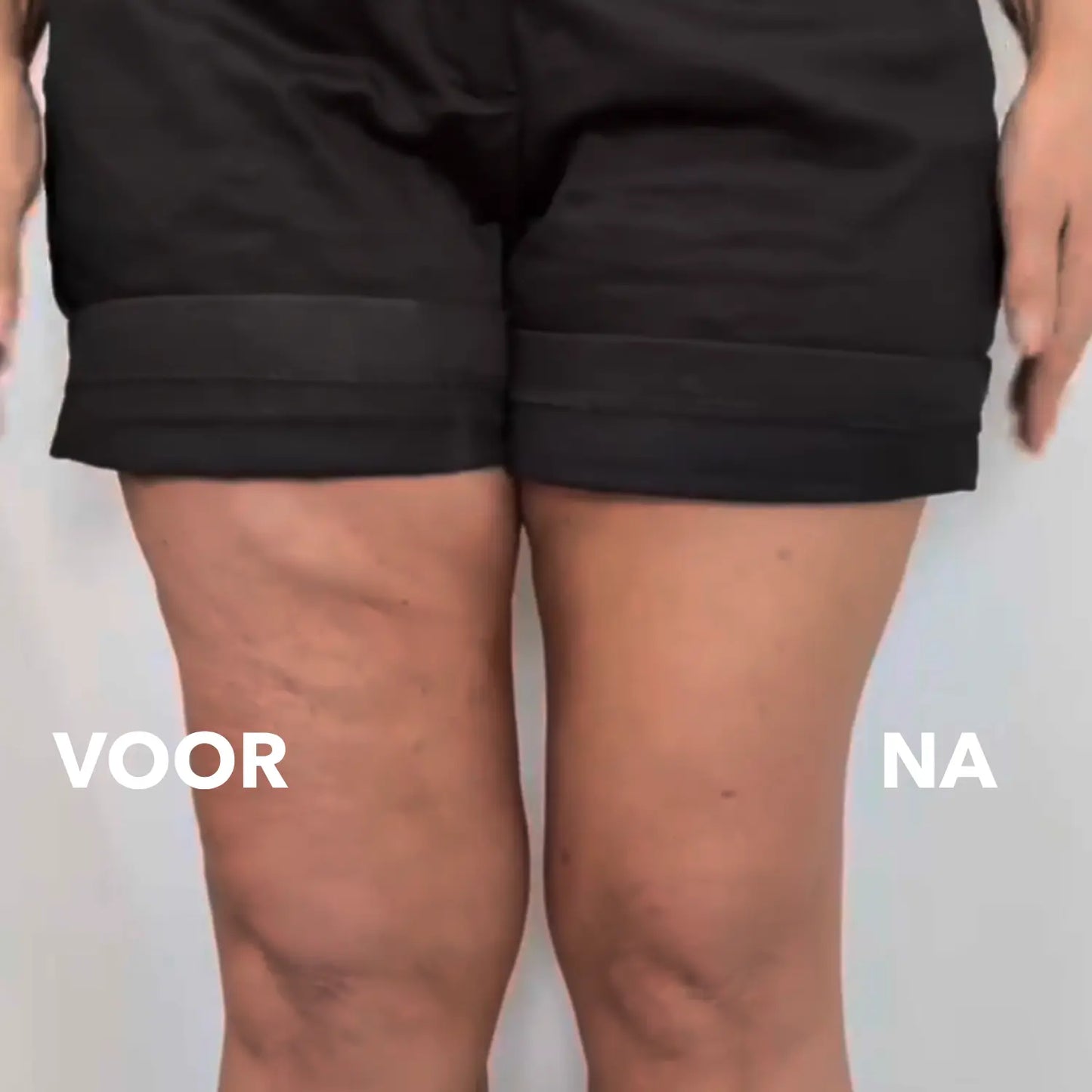 VelvetLift™ | De sticker die de huid in één keer glad strijkt (10 Stuks)