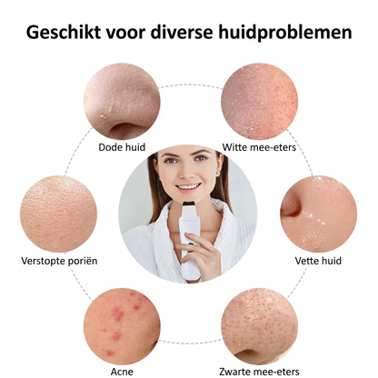 Ultra Gezichtsreiniger Pro - Pakt huidproblemen doelgericht aan