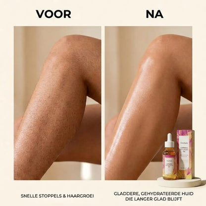 Anti haargroei olie - Effectiever dan laseren!